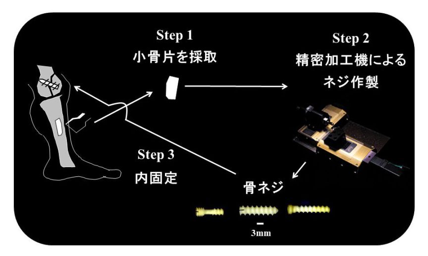 【裁断済】小児骨折治療 小児骨折治療: 書籍／南江堂